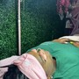 Microdermabrasion