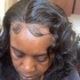 Scalp Treatment