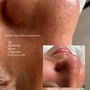 Back Facial