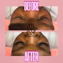 Eyelash Extension Removal