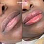 Dark Lip Correction (Lip Neutralizer)