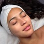 Acne Facial