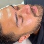 Acne Facial