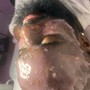 Oxygen Facial