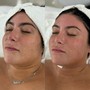 Advanced facial (chemical peel included)