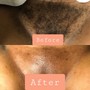 Brazilian Wax