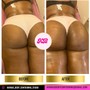 BUTT ENHANCEMENT/LIFTING