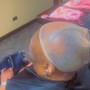 Scalp Treatment