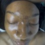 Oxygen Facial