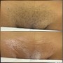 Men’s Brazilian Sugaring