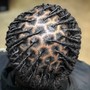 Scalp Treatment