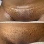 Brazilian Wax