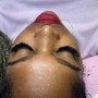 Microdermabrasion Facial Treatment