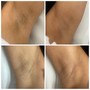 Men’s Brazilian Wax