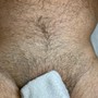 Men’s Brazilian Wax + Penacial