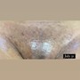 Arm Sugaring