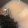 Hot Oil Treatment