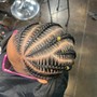 Loc Coils