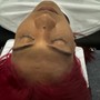 Scalp Treatment