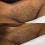 Brazilian Wax