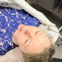 Microdermabrasion Facial