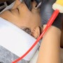 Microdermabrasion Facial