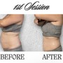 Body Sculpting Package (6 Sessions)