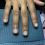 Nail Repair