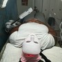 Body Microdermabrasion