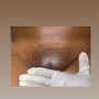 Brazilian Wax