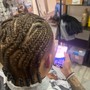 Loc Coils