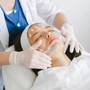 Microdermabrasion