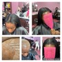 Scalp Treatment