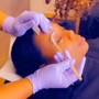 Eyelash Extension Removal