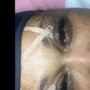 Eyelash Extension Removal