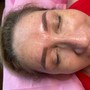 Back Facial