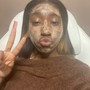 Acne Facial