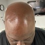 Hairline Waxing