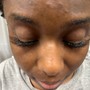 Eyelash Extension Removal