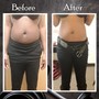 Fat Reduction