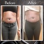 Fat Reduction