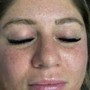 Eyelash Extension Removal