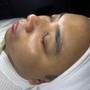 Dermaplaning Facial