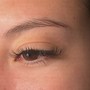 Eyelash Extension Removal