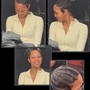 Scalp Treatment