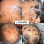 Scalp & Hair Rejuvenator (New Clients)