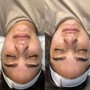 Glow Getter Facial with Dermaplaning