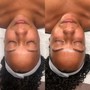 Oxygen Infusion Facial