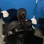 Scalp Treatment