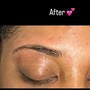 Eyebrow: Microblading